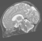 Newborn T2w MRI