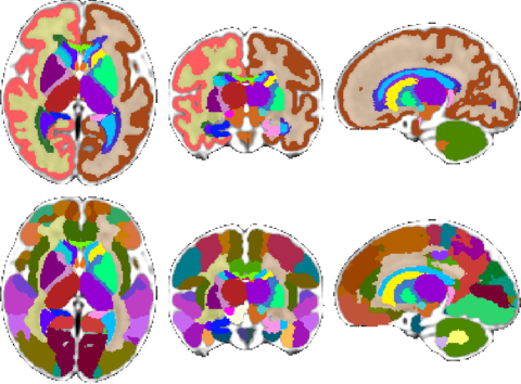 Fetal Brain Atlas tissue and regional segmentations